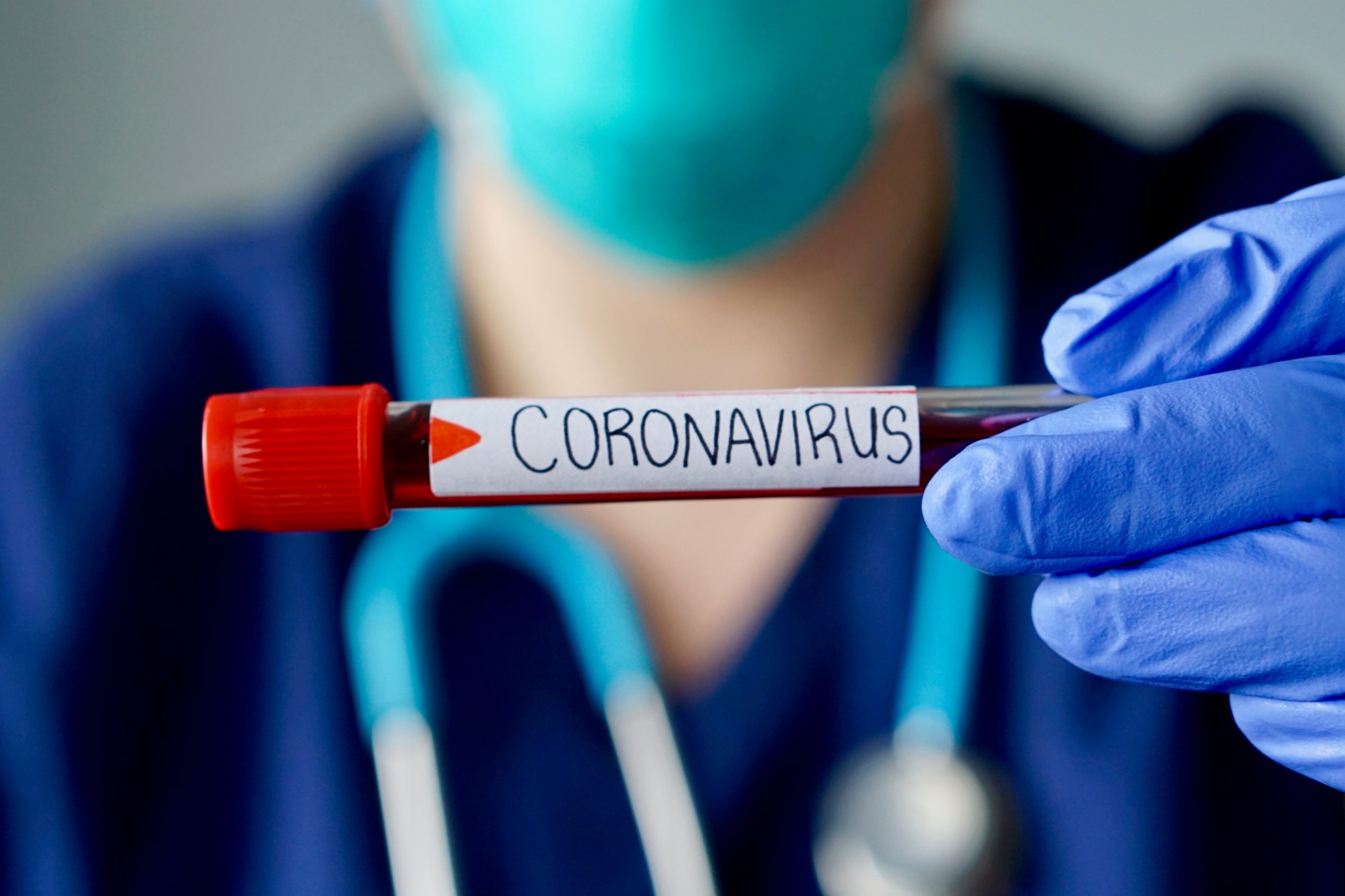 médico segura amostra de sangue com etiqueta escrito coronavírus