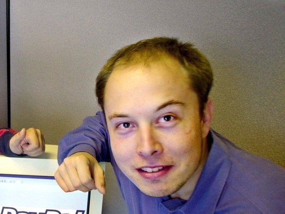 Elon Musk careca