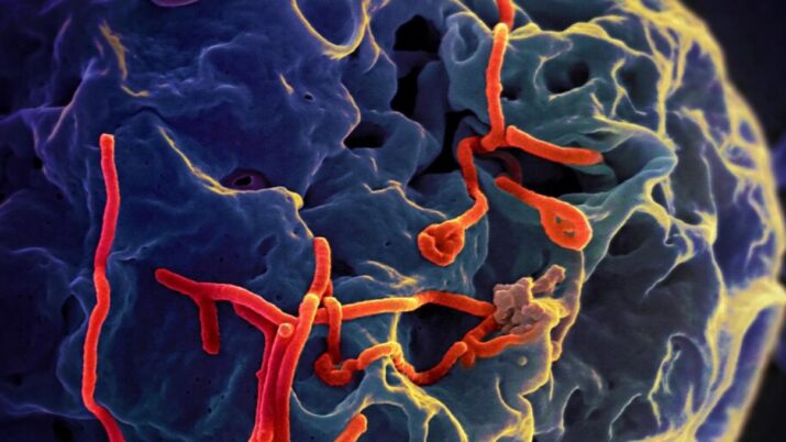 Ebola